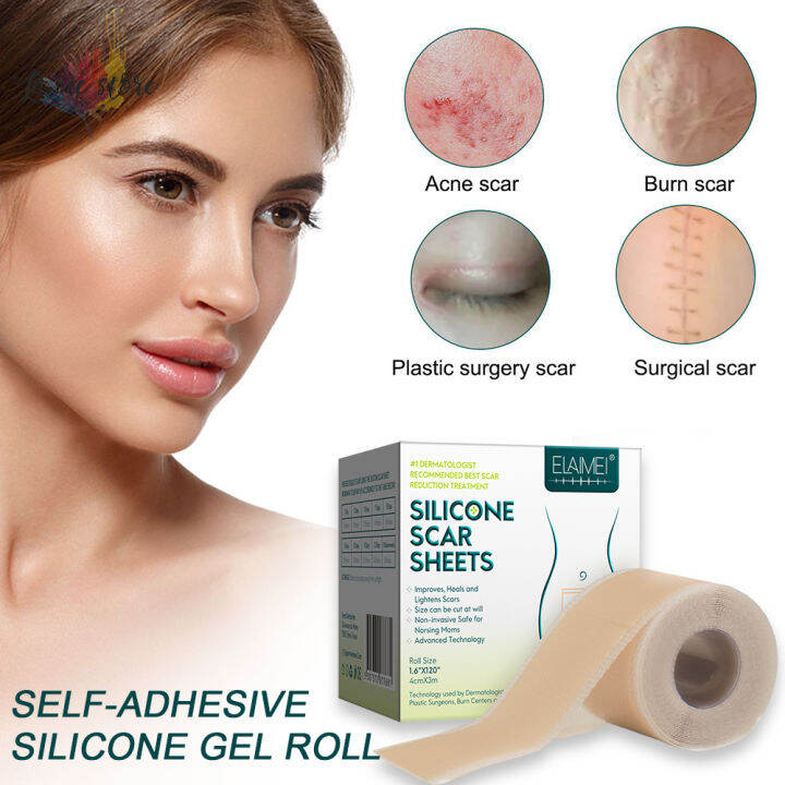 [La vis] Scars Removal Stickers Selfadhesive Silicone Scar Scar Lightening Patches Scar Removal