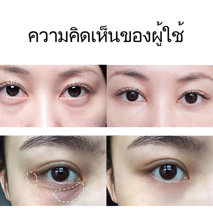 เห็นผลได้ใน-3-วัน-อายครีม-20g-ให้ความชุ่มชื่น-ขอบตาดำ-ถุงใต้ตา-ริ้วรอย-รอยตีนกา-ริ้วรอยร่องแก้ม-ตาบวม-าลดริ้วรอย-เซรั่มทาถุงใต้ตา-ครีมลดถุงใต้ตา-ครีมไต้ตา-ครีมทาตาดำ-ครีมทารอบดวงตา-ครีมทาถุงใต้ตา-เซรั