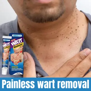 Dr. Scholl's Skin Tag Wart Remover Device Freeze Away Remove Fast