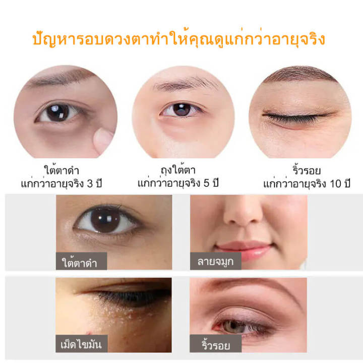 eye-cream-อายครีม-ครีมบำรุงรอบดวงตา-ครีมทาใต้ตา-ลดริ้วรอยรอบดวงตา-ลดความหมองคล้ำ-ลดใต้ตาดำ-ลบรอยตีนกา-ยกกระชับ-ลดความหมองคล้ำ