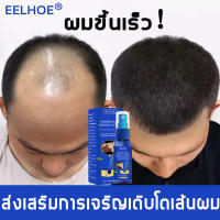 น้ำยาปลูกผม EELHOE（ประกอบด้วยสารสกัดจากพืชหลายชนิด บำรุงล้ำลึก อ่อนโยนและไม่ระคายเคือง เร่งให้คิ้วเติบโต）เร่งผมขึ้นใหม่,น้ำยาปลูกผม,รักษาผมร่วง,เซรั่มปลูกผม,ยาปลูกผมของแท้,ป้องกันผมร่วง,ปลูกผมเร่งด่วน,น้ำยาเร่งผมยาว,สเปรย์ปลูกผม