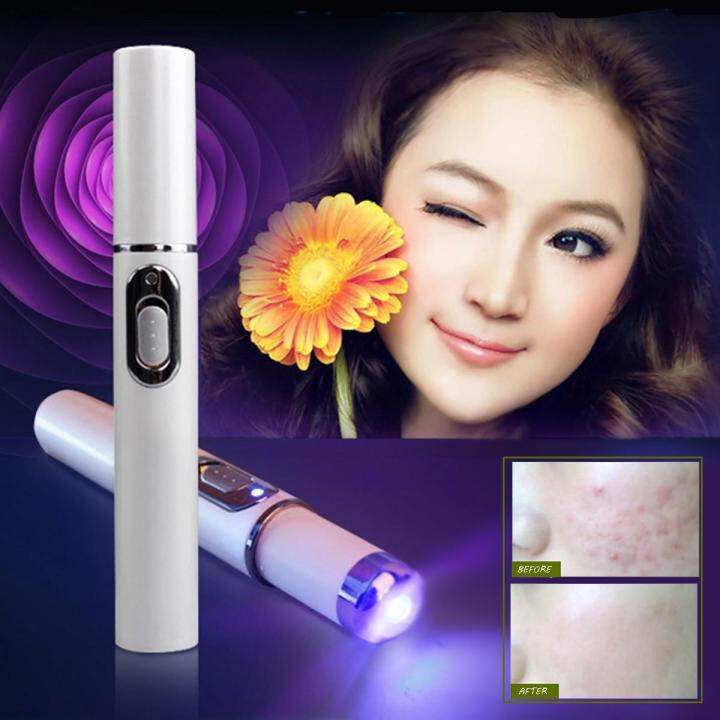 KD7910 Blue Light Acne Treatment Lazada PH