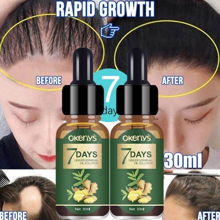 Hair grower spray Growth essense Loss serum Fast hair growth Scalp