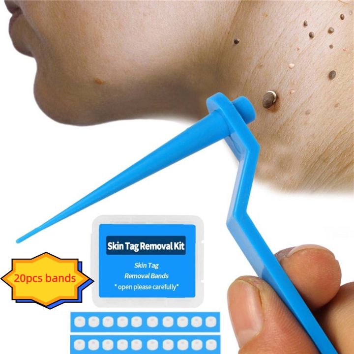 Warts Remover Original Skin Tags Remover Kit Face Care Mole Remover Effective Wart Removal Tool