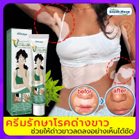 [โปรโมชั่น] ?7วัน เห็นผล?South Moon ครีมทาด่างขาว 20g สารสกัดจากสมุนไพร ไม่ระคายเคือง ใช้ได้ทั้งร่างและทุกวัย ผลิตภัณฑ์กระตุ้นการสร้างเม็ดสีของผิว โรคด่างขาว โรคผิวหนัง ผลิตภัณฑ์ Vitiligo ด่างขาวที่หน้า ด่างขาวที่หลัง ด่างขาวที่แขน ด่างขาวที่ขา ยาด่างขา