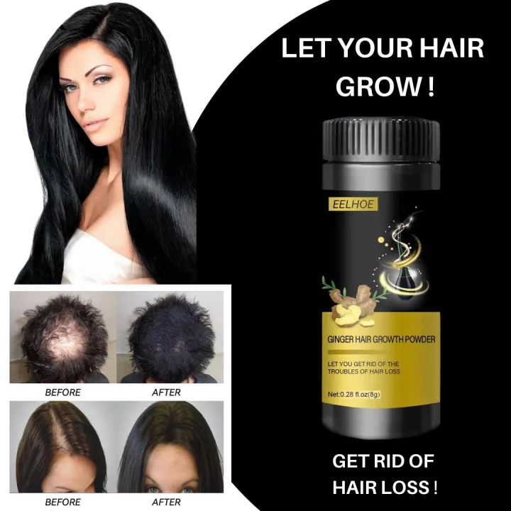 ORIGINAL ginger Hair Growth Powder essence nourishing hair for men for  women effective hair loss problem