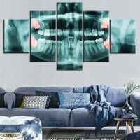 5ชิ้น X-Ray คลินิกฟันเกี่ยวกับฟันเต็มรูปแบบทันตแพทย์ศิลปะบนผนังภาพโปสเตอร์สีน้ำมัน5F 0809