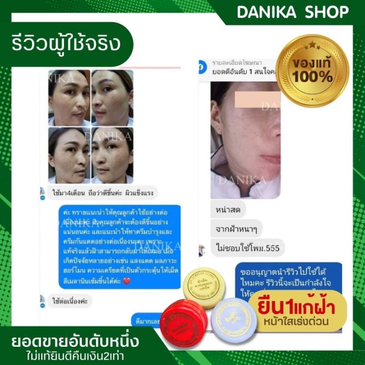 พร้อมส่ง-ครีมทาฝ้า-ครีมฝ้าเย็น-รักษาฝ้า-ทาก่อนนอน-คลินิกหมอสมศักดิ์