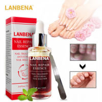 Lanbena fungal NAIL Repair Serum Care Treatment เท้าเล็บเจลกำจัดเชื้อรา Anti paronychia onychomycosis.