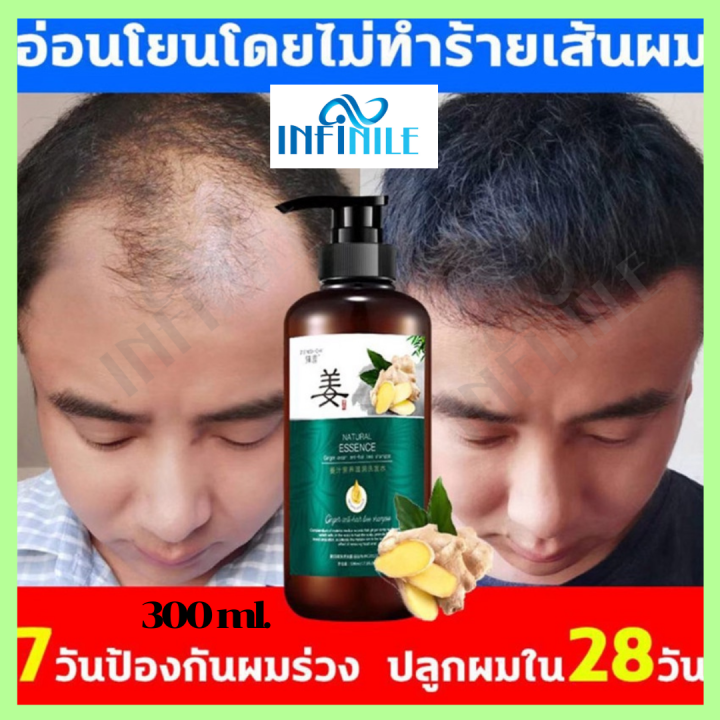 แชมพูแก้ผมร่วง-แชมพูขิง-ขิงช่วยป้องกันผมร่วง-แชมพูสำหรับป้องกันผมขาดหลุดร่วงพร้อมบำรุงผม-ขิงบำรุงลึกถึงราก-ปลูกผมให้สวยเงางาม