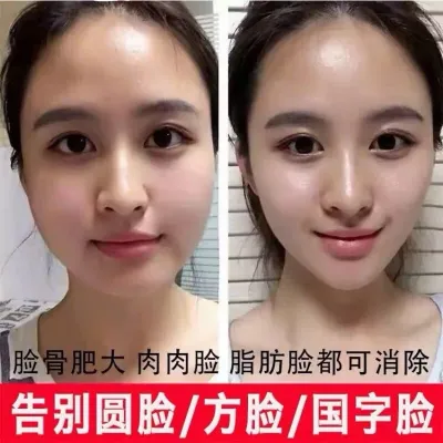 Hundred grass family [work] artifact quickly double chin thin thin thin face masseter frame lift firming V face