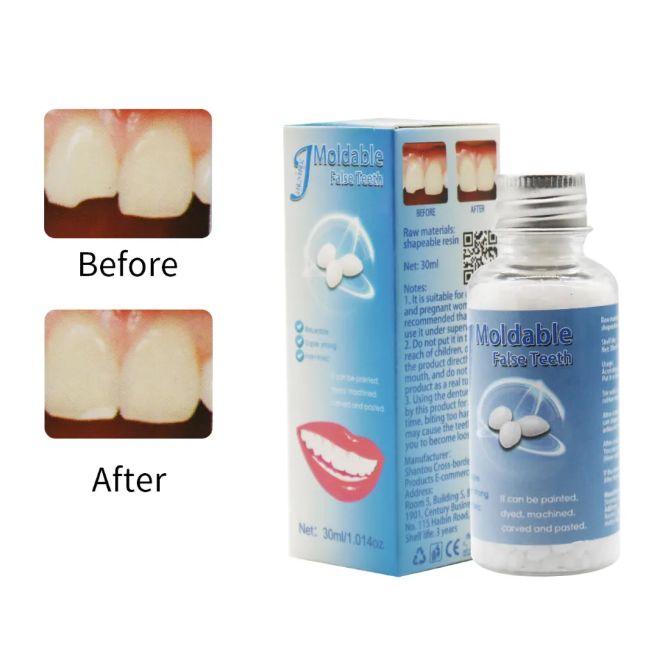 30ML Temporary Tooth Repair Kit Filling Teeth Gaps Moldable False