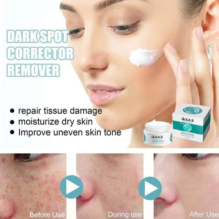 Dr Hancy Japanese Melasma White Spot Cream Lazada Ph 0743