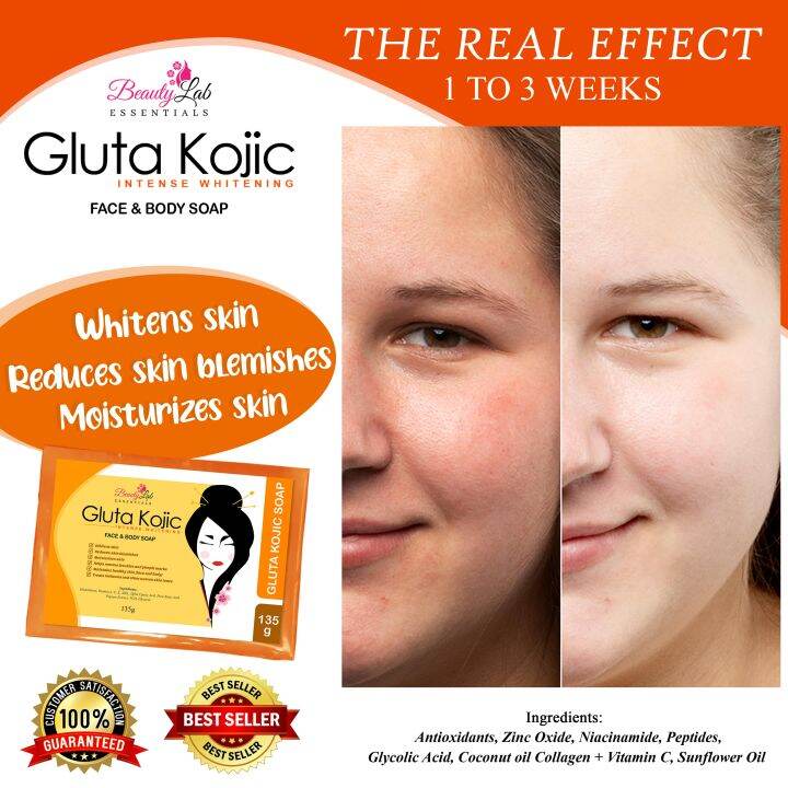 Beautylab Essentials Gluta Kojic Soap 135 Grams Original Vitamins