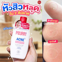 Kimhanshops Peurri Acne Cleanser 100 ml