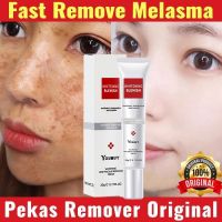 Whitening Freckle Cream Melasma Cream Pekas Remover Dark Spots Remover Brighten Skin Anti-Aging Skin Whitening Cream