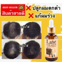 ?สินค้าขายดี?  น้ำยาปลูกผม น้ำยาปลูกคิ้ว แก้ผมร่วงยาแก้ผมร่วง  น้ำยาเร่งผมยาว น้ำยาใส่ผม โลชั่นปลูกผม  ปลูกไรผม X1 (10 มล.)