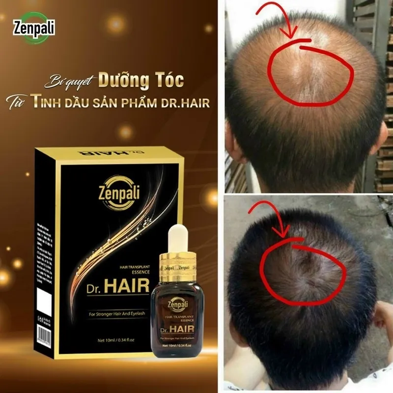 Promo Authentic Dr Hair Zenpali hair growth essence | Lazada