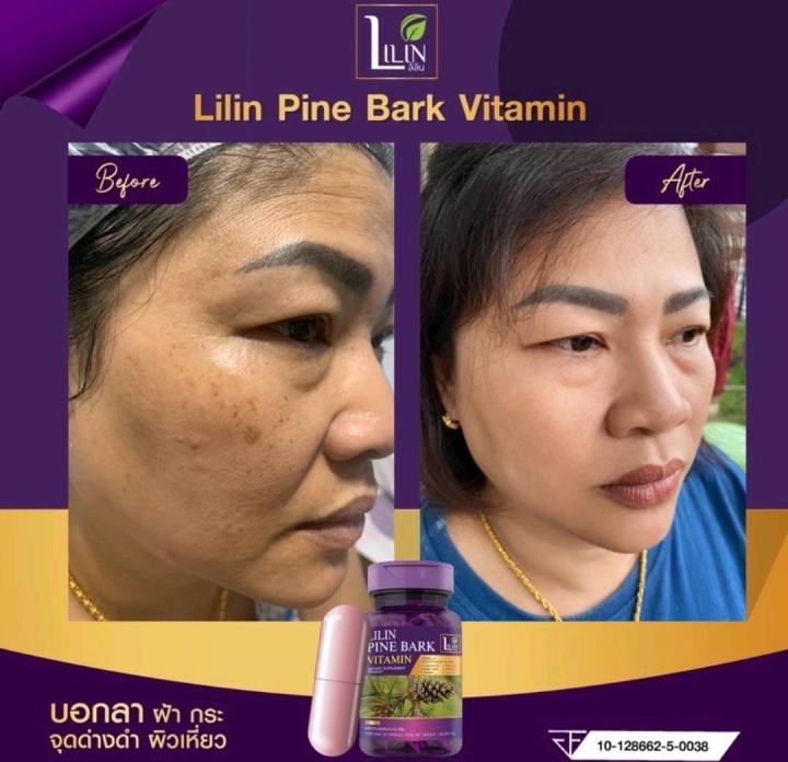 ใหม่-lilin-pine-bark-วิตามินlilin-วิตามินลดฝ้า-วิตามินสลายฝ้า-วิตามินแก้ฝ้า-lilin-pine-bark-vitamin-สลายฝ้า-กระ-จุดด่างดำ-ริ้วรอย