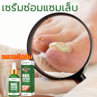 (ของแท้ 100%) เซรั่มรักษาเล็บ30ml กำจัดเชื้อราที่เล็บ รักษาเล็บขบ เล็บหนา เล็บเปราะ เล็บไม่เรียบ เล็บแตก ฯลฯ บำรุงเล็บให้สวย รักษาเล็บ ซ่อมแซมโรคเชื้อราที่เล็บ น้ำยาซ่อมแซมเล็บ น้ำยารักษาเล็บ น้ำมันบำรุงเล็บ เอ็สเซ้น ยาทาแก้เชื้อราที่เล็บ ดูแลเล็บ