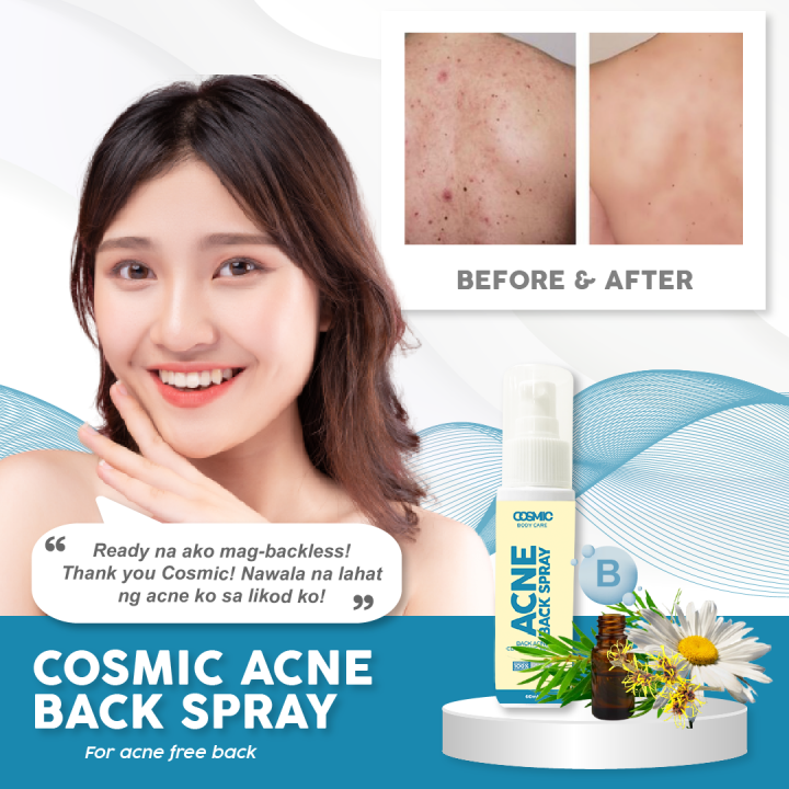 Cosmiclab Back Acne Spray 60ml Lazada PH