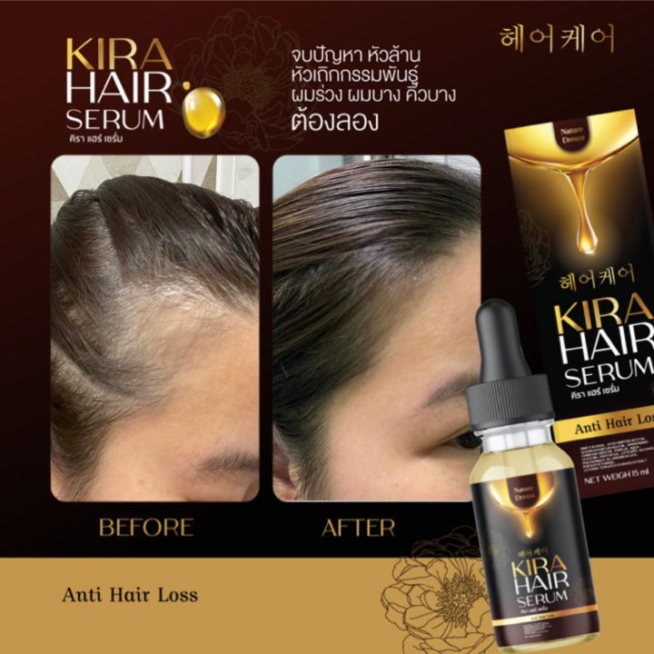 คิรา-แฮร์-เซรั่ม-1แถม1ส่งฟรี-kira-hair-serum-ปัญหาผมร่วงที่แก้ยาก-ครบ-จบ-ในขวดเดียว-แก้ปัญหา-ผมร่วง-ผมบาง-ผมหงอก-คิราแฮร์-แฮร์เซรั่ม