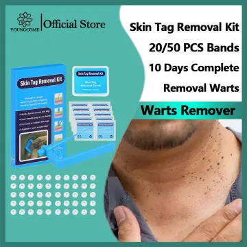 Ibealee Tag And Wart Remover, Skin Tag Removal Natural Skin