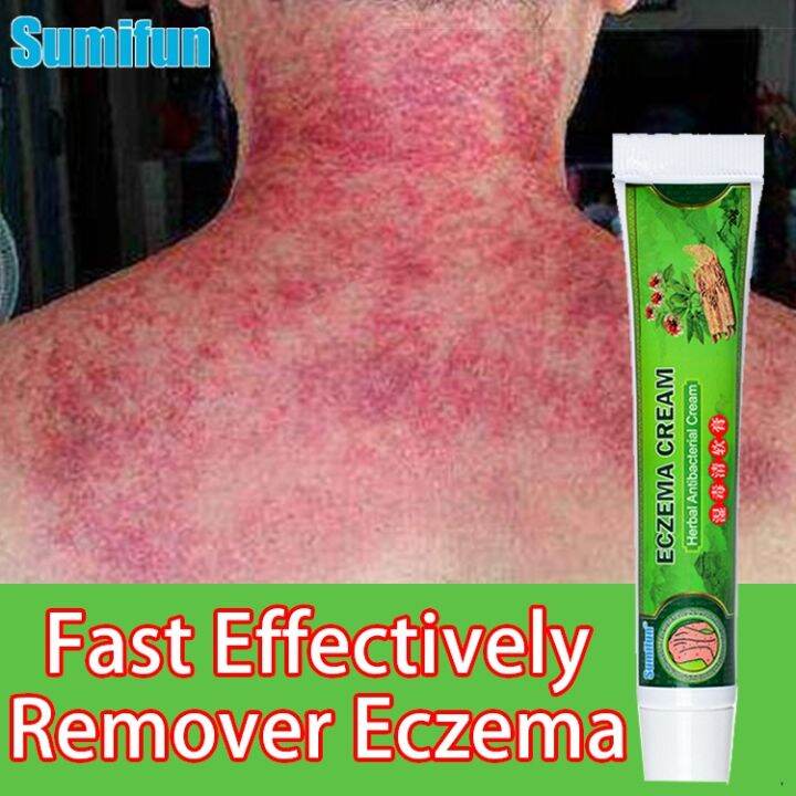 Sumifun Eczema Cream Ointment for Skin Diseases Psoriasis Cream Skin