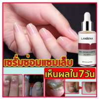 ของแท้ 100% LANBENA เซรั่มบำรุงเล็บ น้ำยาบำรุงเล็บ 15ml บำรุงเล็บ ต่อต้านการติตเชื้อรา ซ่อมแซมเล็บแตก เล็บเปราะ เล็บหนา