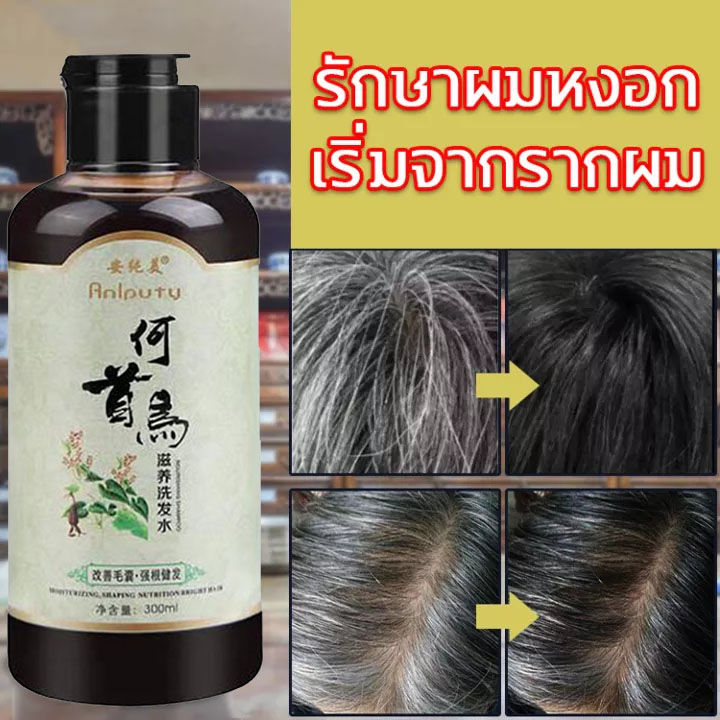 พร้อมส่ง-anyichun-แชมพูปิดผมหงอก-แชมพูแก้ผมหงอก-แชมพูเหอโส่วอู-300ml-แชมภูปิดผมขาว-my-organic-แก้ผมหงอกถาวร-แชมพูปิดหงอก-ผมหงอกกลับมาดำ-แก้ผมหงอก-แชมพูสมุนไพร-น้ำยาแก้ผมหงอก-แชมพูผมดกดำ-เซรั่มลดผมหงอก