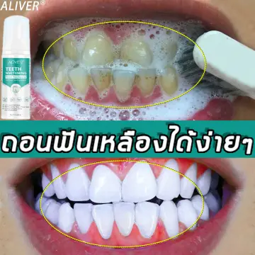 ฟองฟันขาว ราคาถูก ซื้อออนไลน์ที่ - มิ.ย. 2023 | Lazada.co.th ฟองฟันขาว ราคาถูก ซื้อออนไลน์ที่ - มิ.ย. 2023 | Lazada.Co.Th