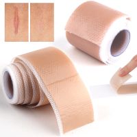 Silicone Scar Removal Sheet Acne Trauma Burn Scar Skin Repair Keloid Silicone Patch Efficient Surgery Caesarean Section Gel Scar in stock