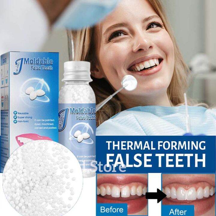 (COD)Moldable Falseteeth DIY Tooth Repair Kit Teeth Filling Solid Glue Temporary Teeth