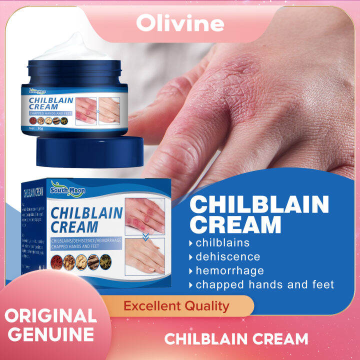 South Moon Chilblain Ointment Herbal Hand Foot Chapped Skin Care Heel