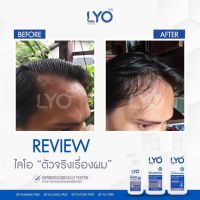 1 เซต ฟรี แชมพู ครีมนวด ??  LYO ไลโอ แชมพู ครีมนวด โทนิค ผลิตภัณฑ์บำรุงเส้นผมและหนังศีรษะ หนุ่มกรรชัยพร้อมส่งวันที่สั่ง ของแท้?