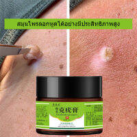 wart remover cream ยาแต้มหูด 20g  ลอกหูดตาปลา ฆ่าเชื้อรา ปลอดภัยไม่เจ็บตัว ขจัดติ่งเนื้อ เอสเซ้นลอกหูด ไม่ทิ้งร่องรอยป  ครีมกําจัดไฝหูดติ่งเ