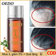 OEDO Tinh chất kích thích mọc tóc ngăn rụng tóc bóng mượt không mùi chiết xuất nhân sâm Hàn Quốc - INTL thumbnail
