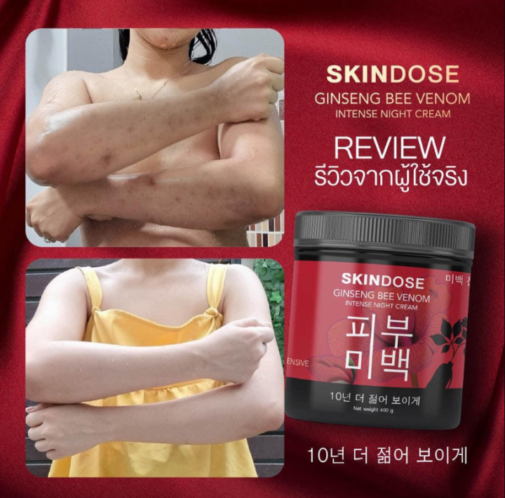 1-กระปุก-skindose-ginseng-bee-venom-ครีมโสมพิษผึ้งจักรพรรดิ-สูตรกลางคืน-ปริมาณ-400-g-1-กระปุก