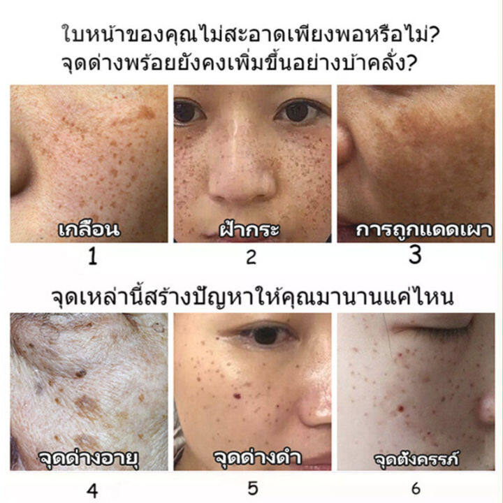 eelhoe-ครีม-แก้-ฝ้า-กระ-ทาฝ้าของแท้-ครีมทาฝ้า-vitamin-c-ครีมแก้ฝ้าแท้ๆ-ครีมทาฝ้าหนาๆๆ-ครีมแก้ฝ้าถาวร-ไวท์เทนนิ่ง-ให้ความชุ่มชื้น-ต่อต้านริ้วรอย-ลดเลือนริ้วรอย-ลดเม็ดสีเมลานิน