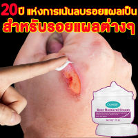 ลบรอยแผลเป็น รอยสิว Scar cream แผลไฟไหม้ ครีมลดรอยแผล ครีมทารอยแผลเป็น ครีมทาแผลเป็น ครีมลบแผลเป็น แผลเป็น ครีมรอยแผลเป็น ครีมลดแผลเป็น รอยแผลเป็น เจลลบรอยแผลเป็น ครีมซ่อมแซม แผลน้ำร้อนลวก ครีมรักษาแผลเป ลดเลือนรอยแผลเป็น ครีมป้องกันรอยแผลเป็น