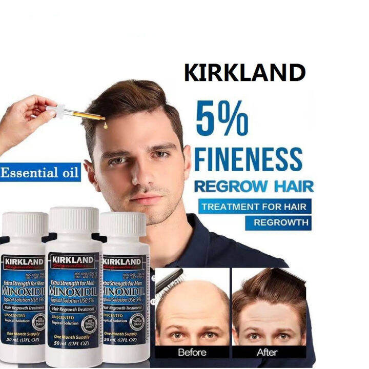 Original Kirkland Minoxidil with LCLT and Dropper 1 Month Supply Hair ...