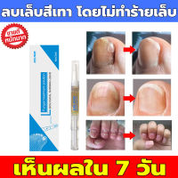 EELHOE เอสเซ้นซ่อมแซมเล็บ แก้ไขปัญหา​เล็บ​หนาที่ก่อตัวนานจากเชื้อรา  Nail Repair Essence Serum Nail Treatment เซรั่มบำรุงเล็บ