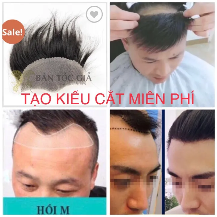 Tóc Giả Mái Hói Nam