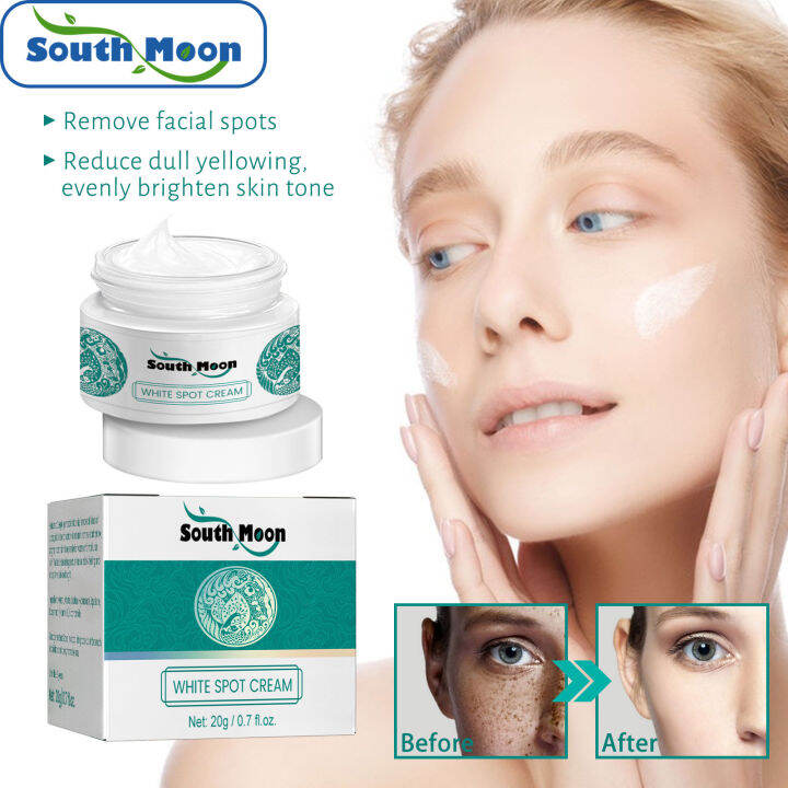 South Moon White Spot Cream Spots Removal Cream Remove Dark Spots South Moon White Spot Cream Spots Removal Cream Remove Dark Spots