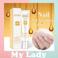 Mylady  Efero การรักษาเล็บเชื้อรา Feet Care Essence Whitening เล็บเท้ากำจัดเชื้อราเจลป้องกันการติดเชื้อ Onychomycosis เล็บ Repair Essence