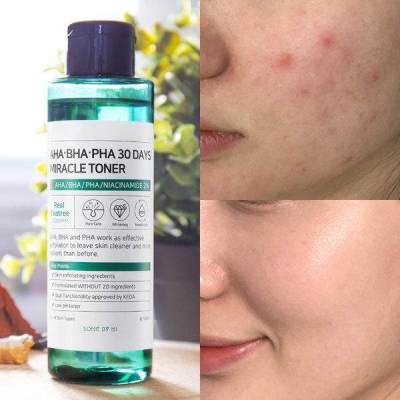 โทนเนอร์ SOME BY MI AHA-BHA-PHA 30DAYS MIRACLE TONER 150ML. ค่าส่งถูก/พร้อมส่ง ของแท้จากซัพเกาหลี