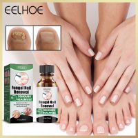 Eelhoe Repair Nail Fungus Treatments Essence Foot Care Serum Toe Nails Fungal Removal Gel Anti-Infection Onychomycosis Essence Serum Care Nails Fungal Removal Repair Hand And Foot Care 30Ml