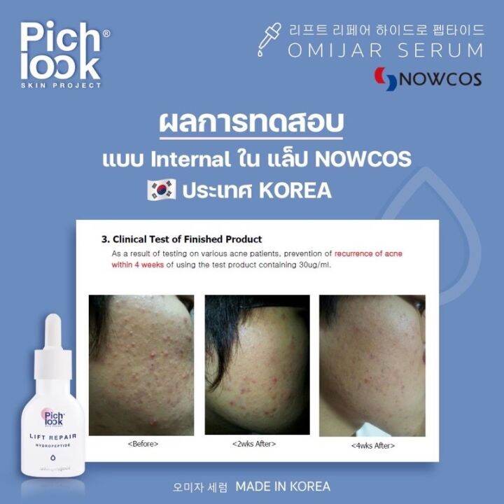 ส่งฟรี-ไม่ต้องเก็บคูปอง-omijar-serum-by-pichlook