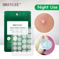 BREYLEE Pimple Patch Stickers Pimple Acne Remover Tool Blemish Spot Acne Treatment Mask Facial Skin Care Waterproof Night Use