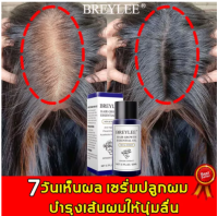 BREYLEE น้ำยาปลูกผม เร่งผมงอกใหม่ ป้องกันผมร่วง น้ำมันปลูกผม เซรั่มปลูกผม 20ml